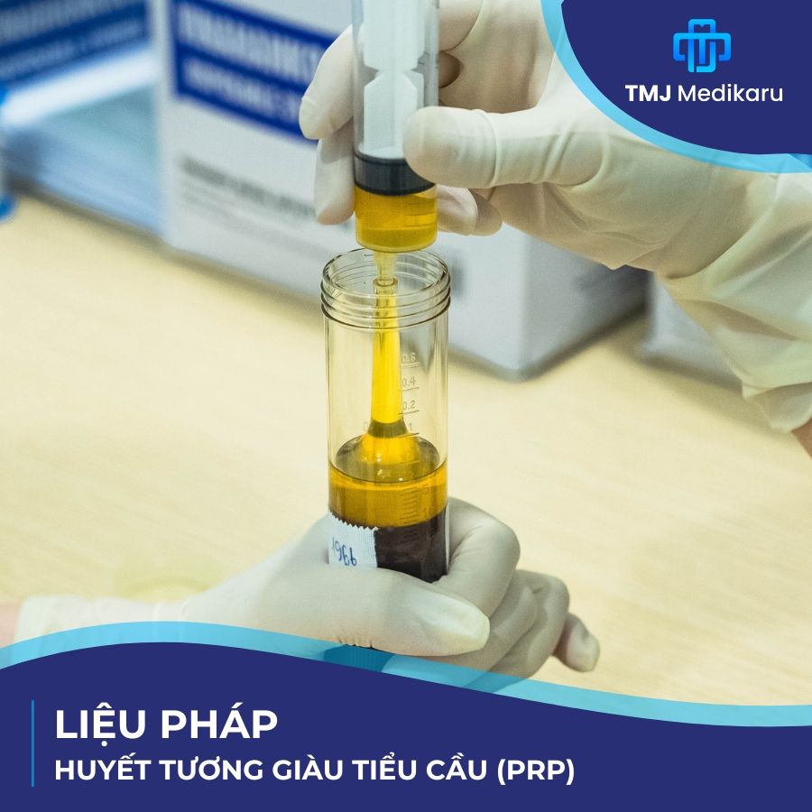 Liệu pháp PRP – Giải pháp y học tái tạo nâng tầm sức khỏe toàn diện tại TMJ